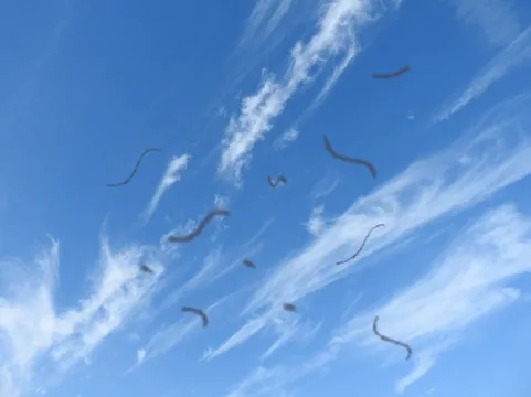 飛蚊症イメージ